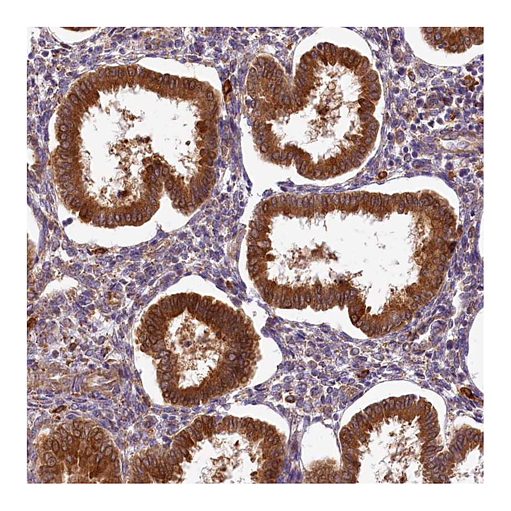 Atlas Antibodies Anti-PPIP5K2 Antibody