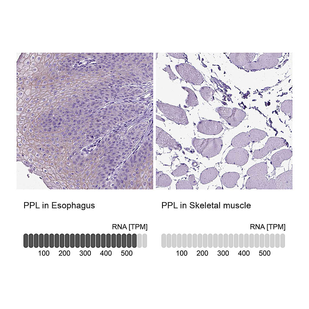 Atlas Antibodies Anti-PPL Antibody