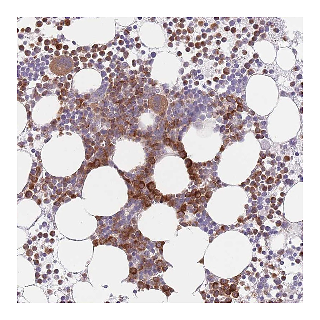 Atlas Antibodies Anti-PPM1A Antibody