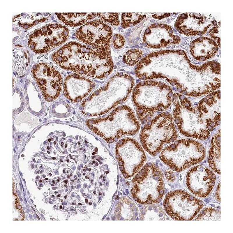 Atlas Antibodies Anti-PPIP5K2 Antibody