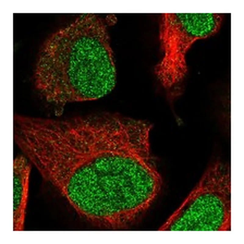 Atlas Antibodies Anti-PPM1D Antibody