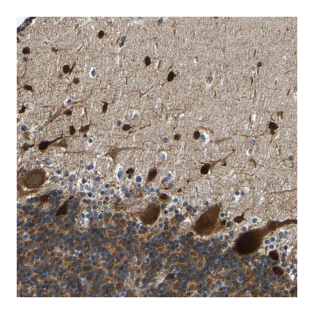 Atlas Antibodies Anti-PPM1E Antibody