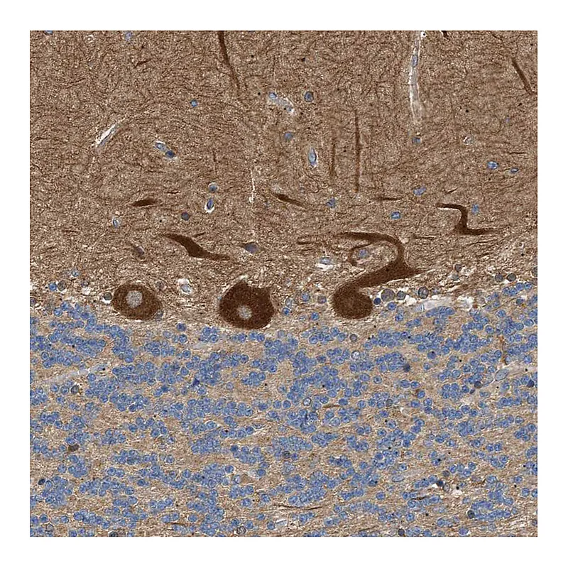 Atlas Antibodies Anti-PPM1B Antibody