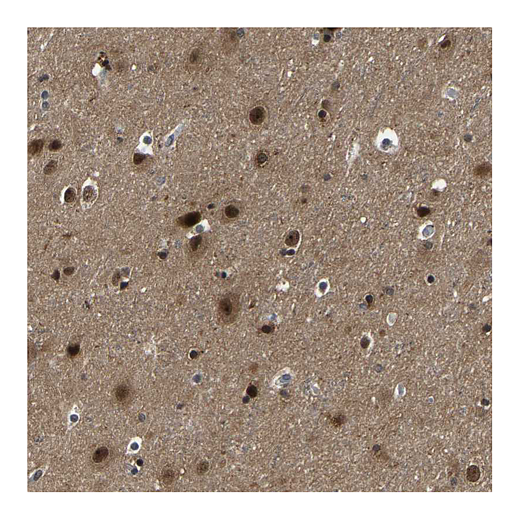 Atlas Antibodies Anti-PPM1E Antibody