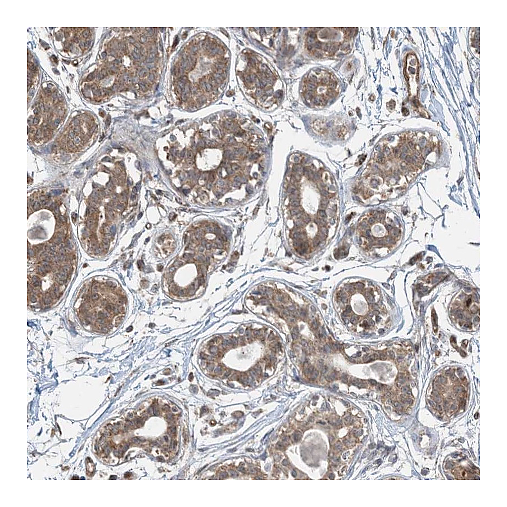 Atlas Antibodies Anti-PPM1F Antibody