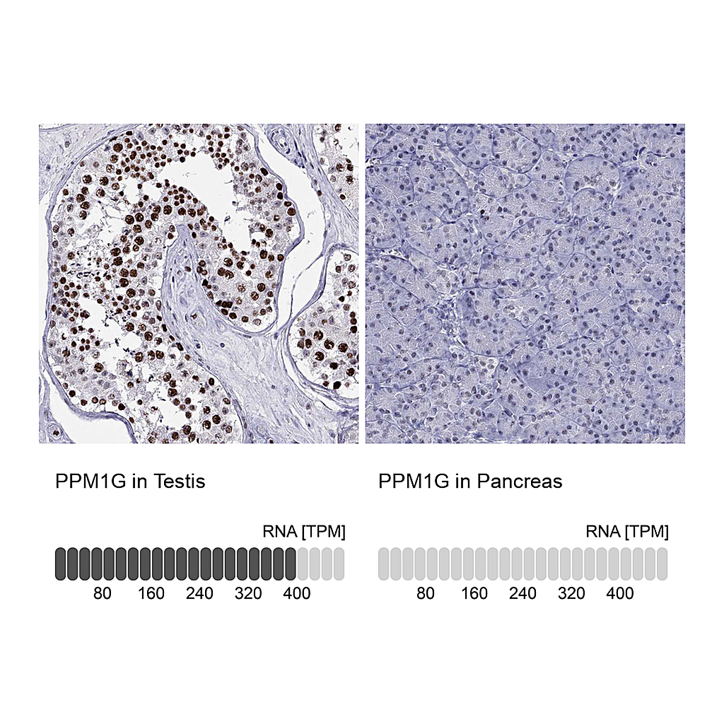 Atlas Antibodies Anti-PPM1G Antibody