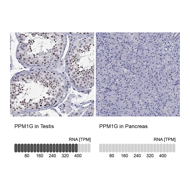 Atlas Antibodies Anti-PPM1G Antibody