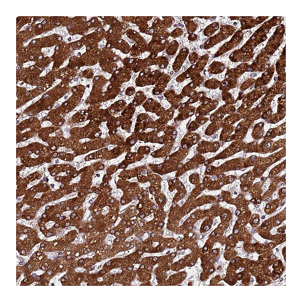 Atlas Antibodies Anti-PPM1H Antibody