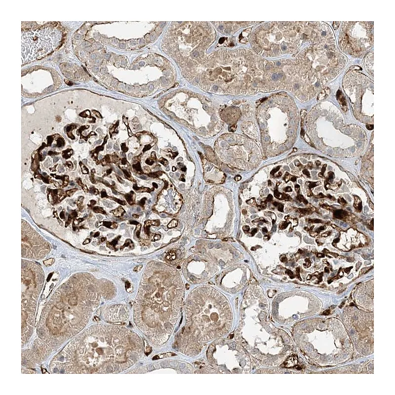 Atlas Antibodies Anti-PPM1F Antibody