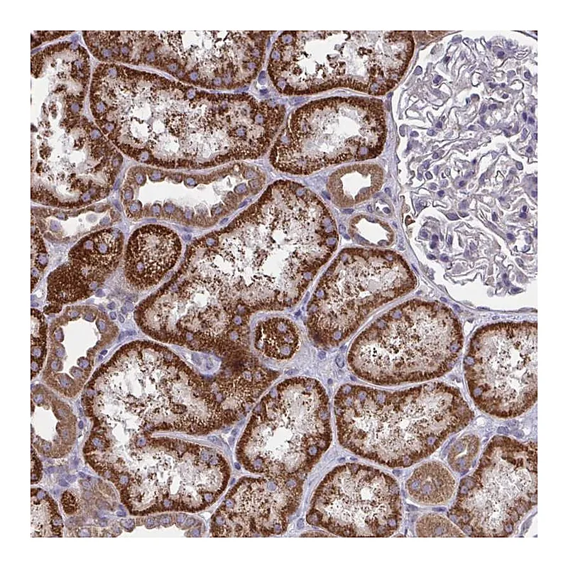 Atlas Antibodies Anti-PPM1H Antibody