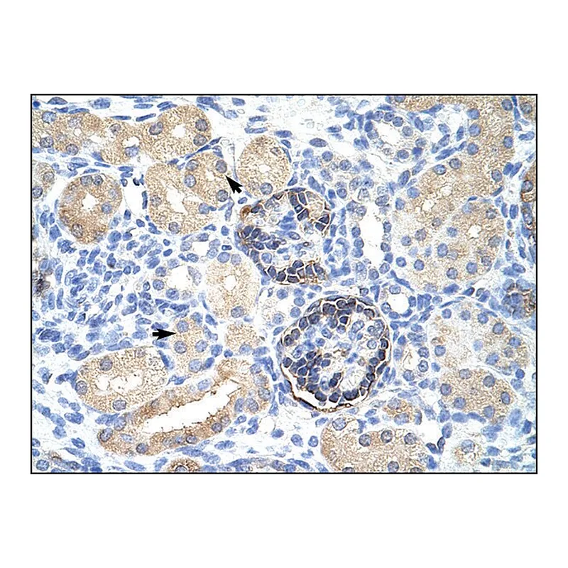 Merck Anti-CLIC5 antibody produced in rabbit