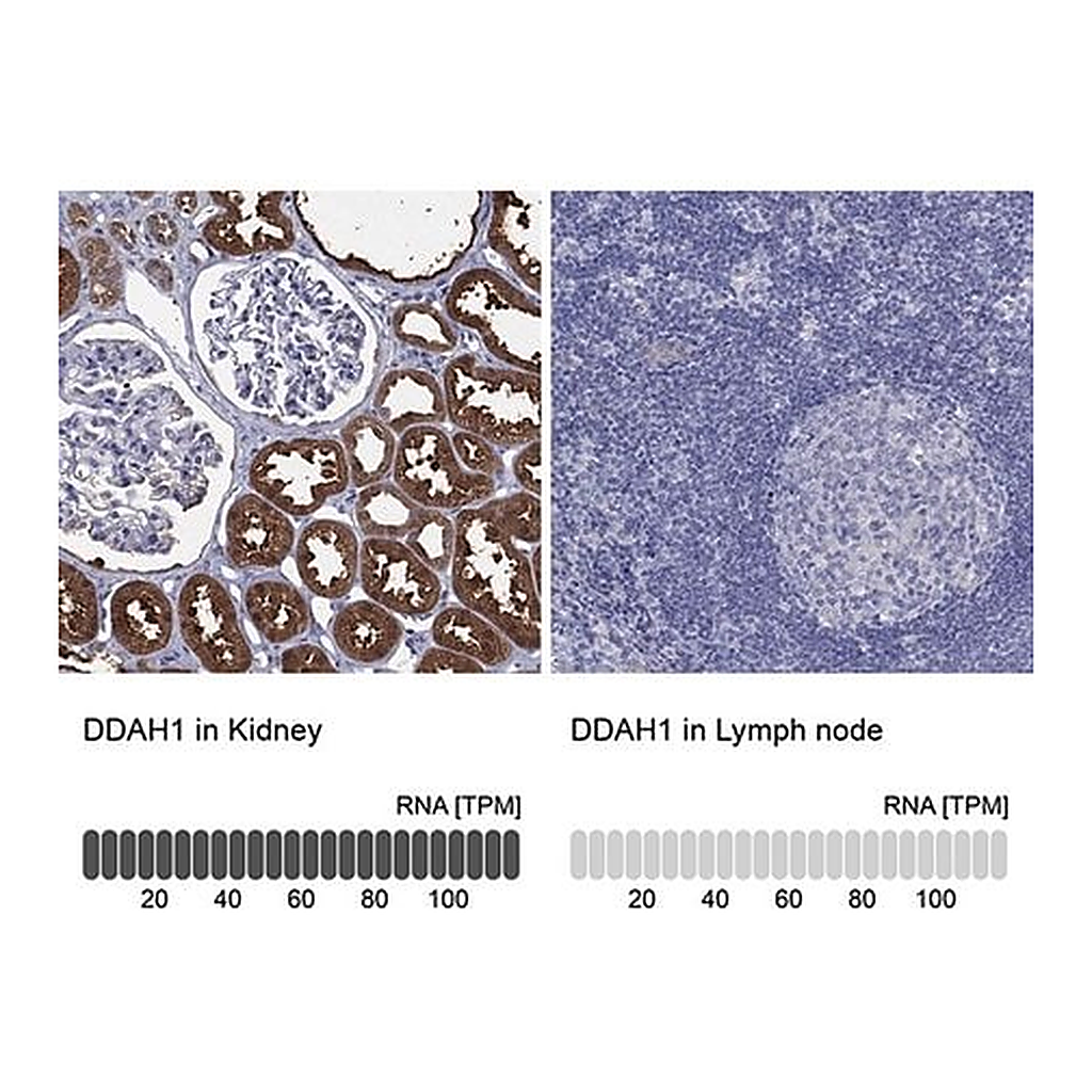 Merck Anti-DDAH1 antibody produced in rabbit