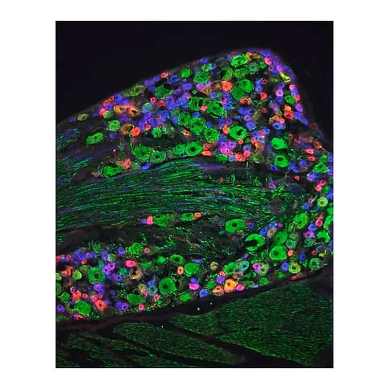 Merck Anti-Neurofilament 160/200 antibody, Mouse monoclonal