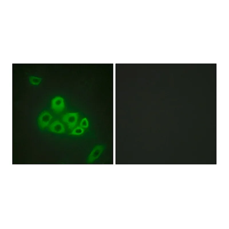 Merck Anti-S1P Receptor EDG1 antibody produced in rabbit