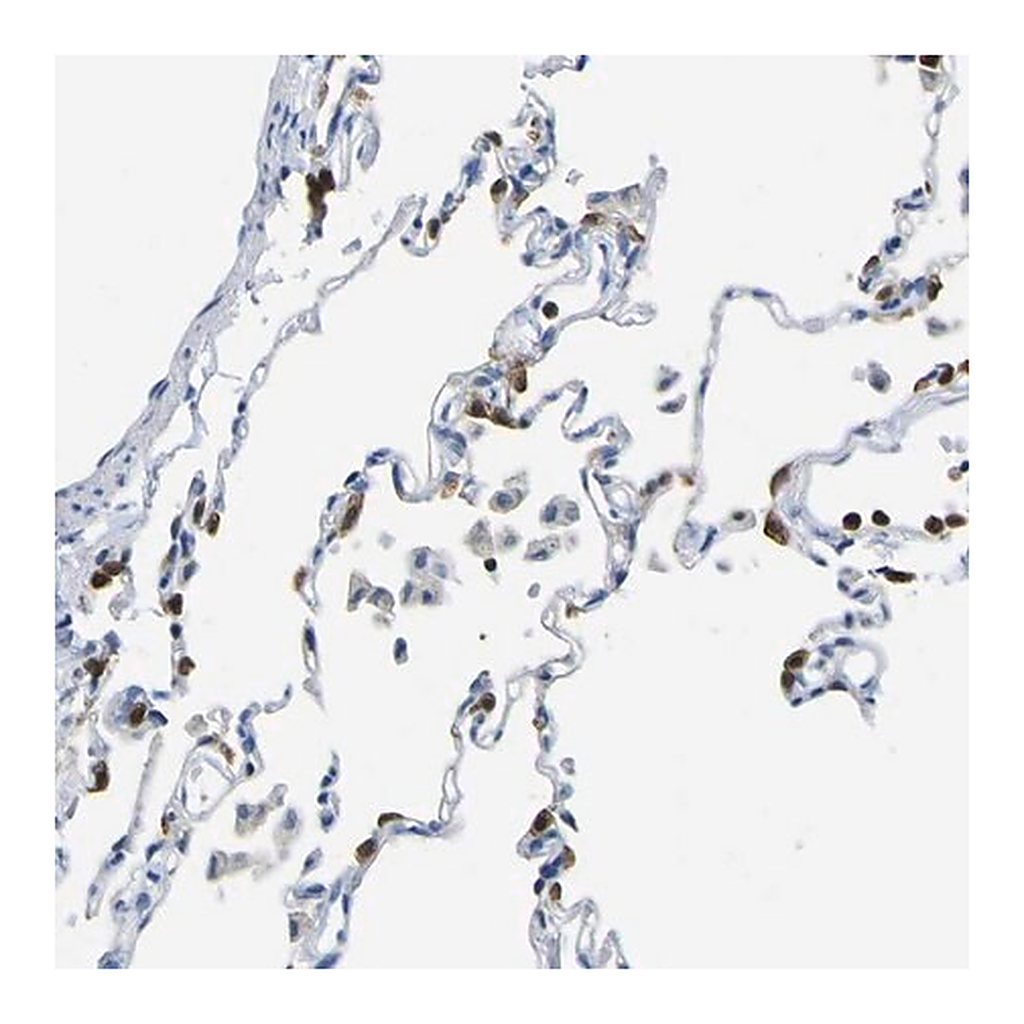 Merck Anti-ABHD3 antibody produced in rabbit