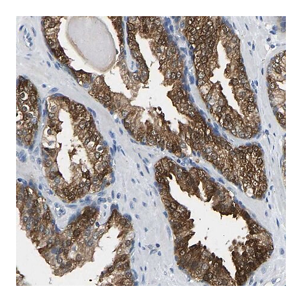 Merck Anti-NDRG3 antibody produced in rabbit