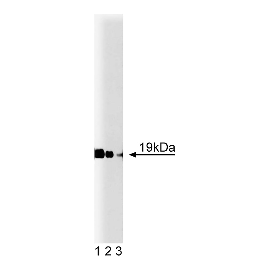 BD Purified Mouse Anti-Cofilin