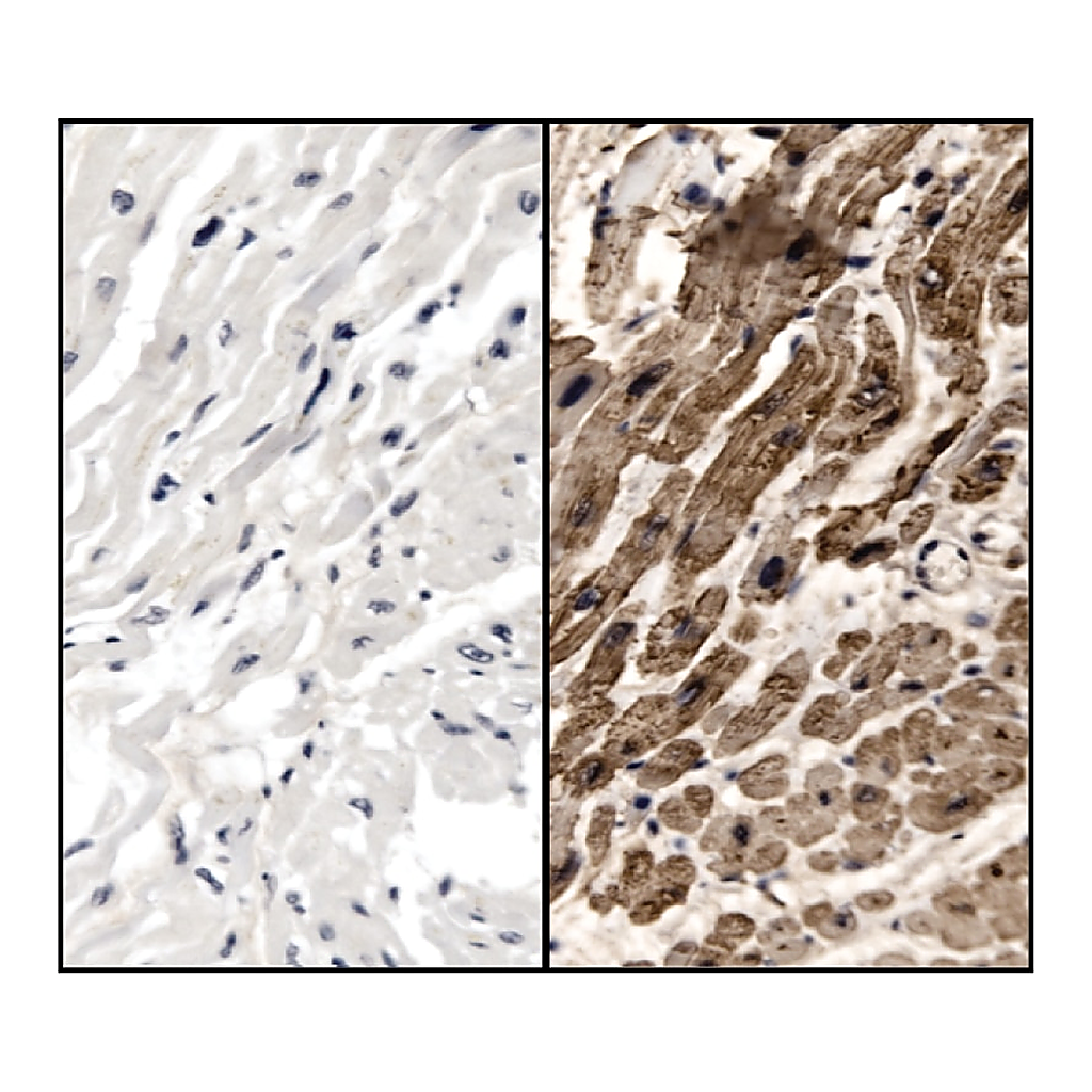 BD Purified Mouse Anti-Cardiac Troponin T