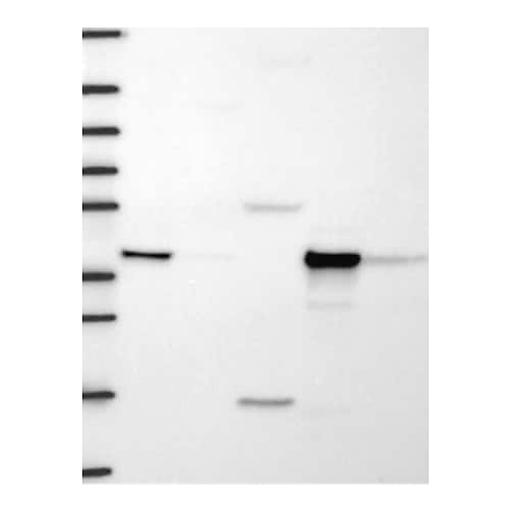 Merck Anti-HIBCH antibody produced in rabbit