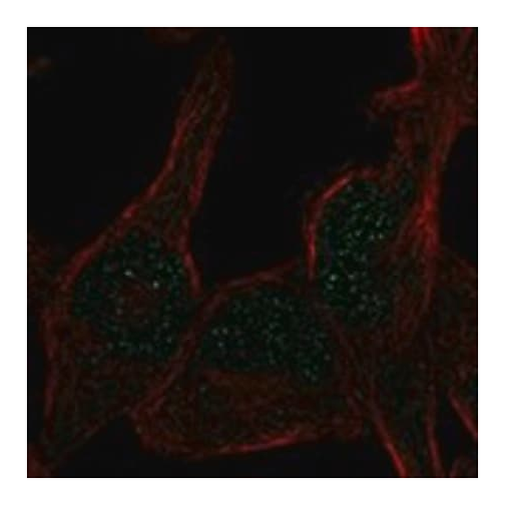 Merck Anti-ERCC6L2 antibody produced in rabbit