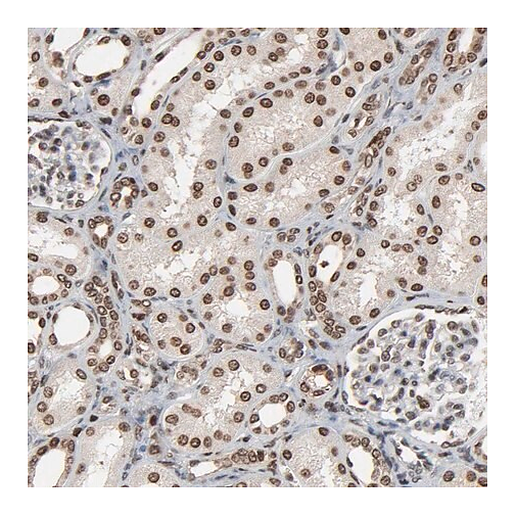 Merck Anti-RPS6KA3 antibody produced in rabbit