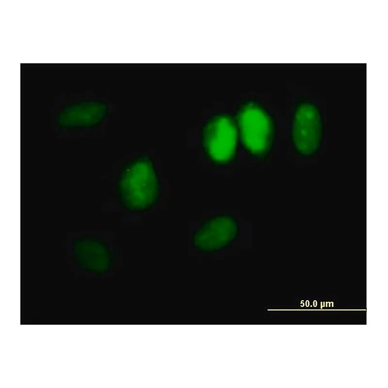 Merck Anti-DDX11 antibody produced in mouse