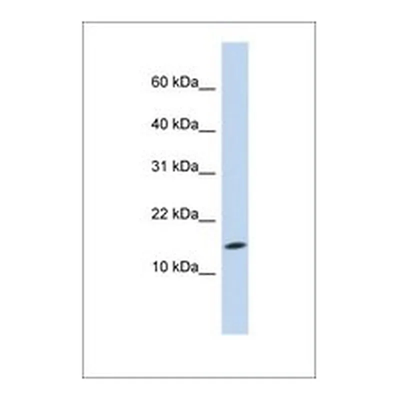 Merck Anti-UBE2D3