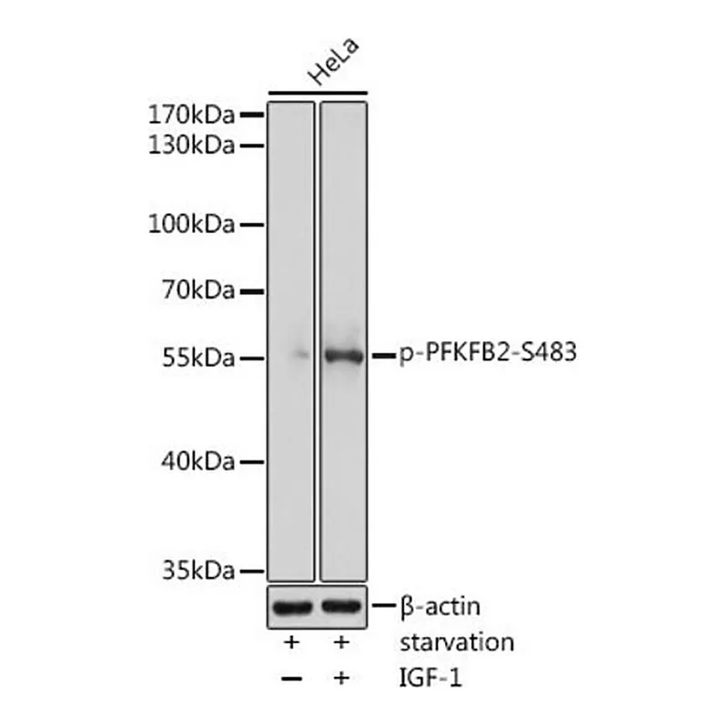 Merck Anti-Phospho-PFKFB2-S483 antibody produced in rabbit