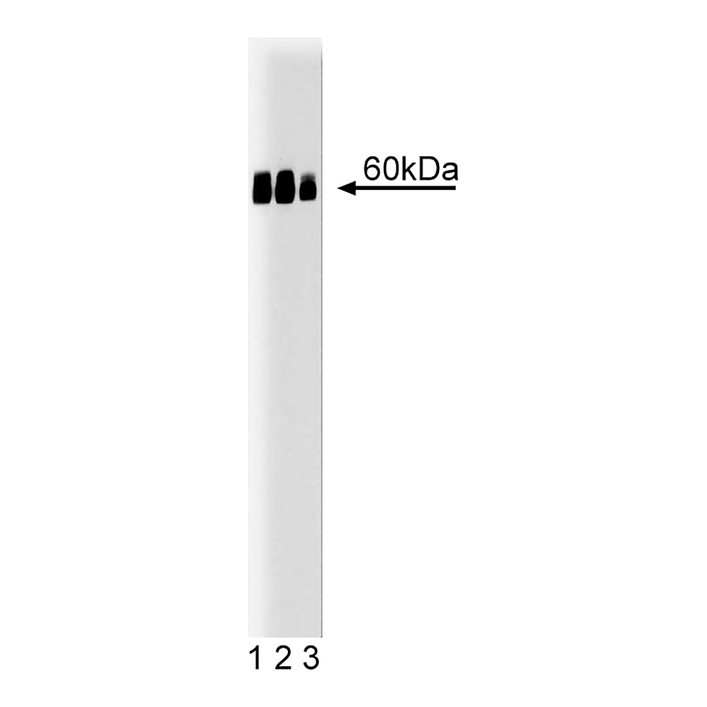 BD Purified Mouse Anti-Calreticulin