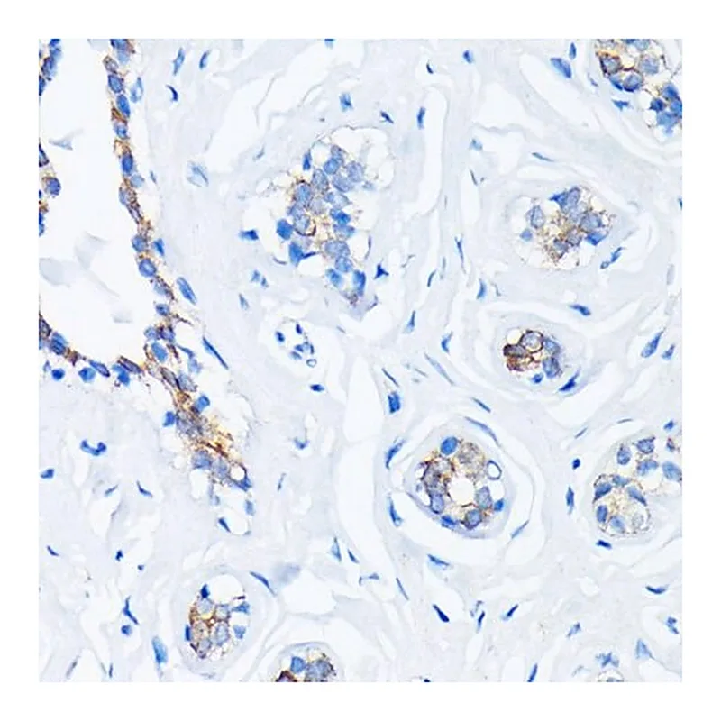Merck Anti-HRAS antibody produced in rabbit