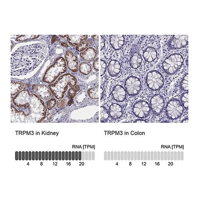 Merck Anti-TRPM3 antibody produced in rabbit
