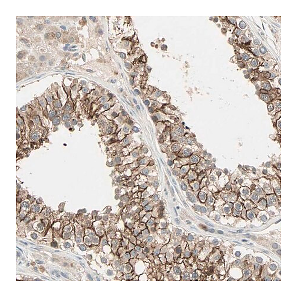Merck Anti-TTF2 antibody produced in rabbit