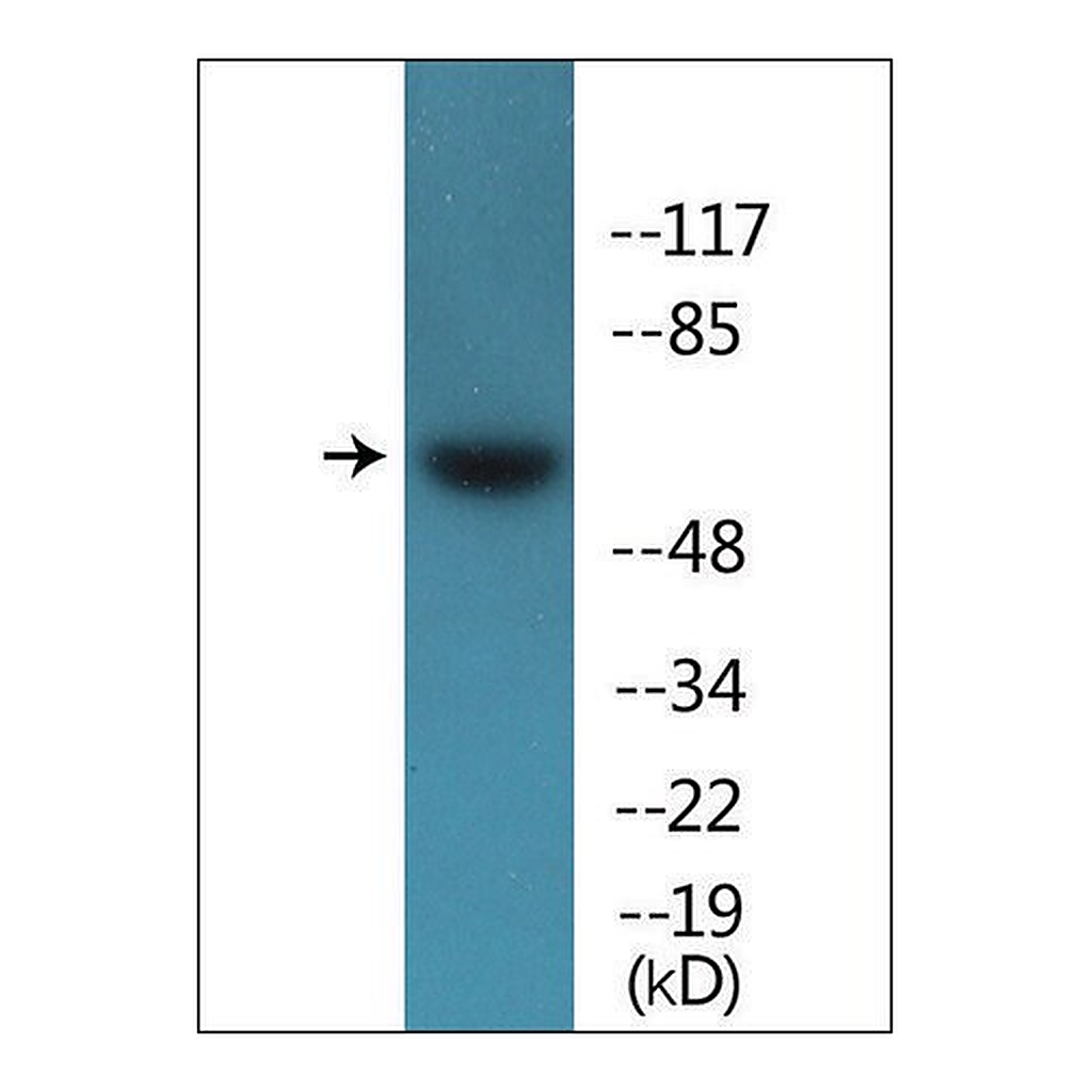 Merck Anti-phospho-Src (pTyr418) antibody produced in rabbit