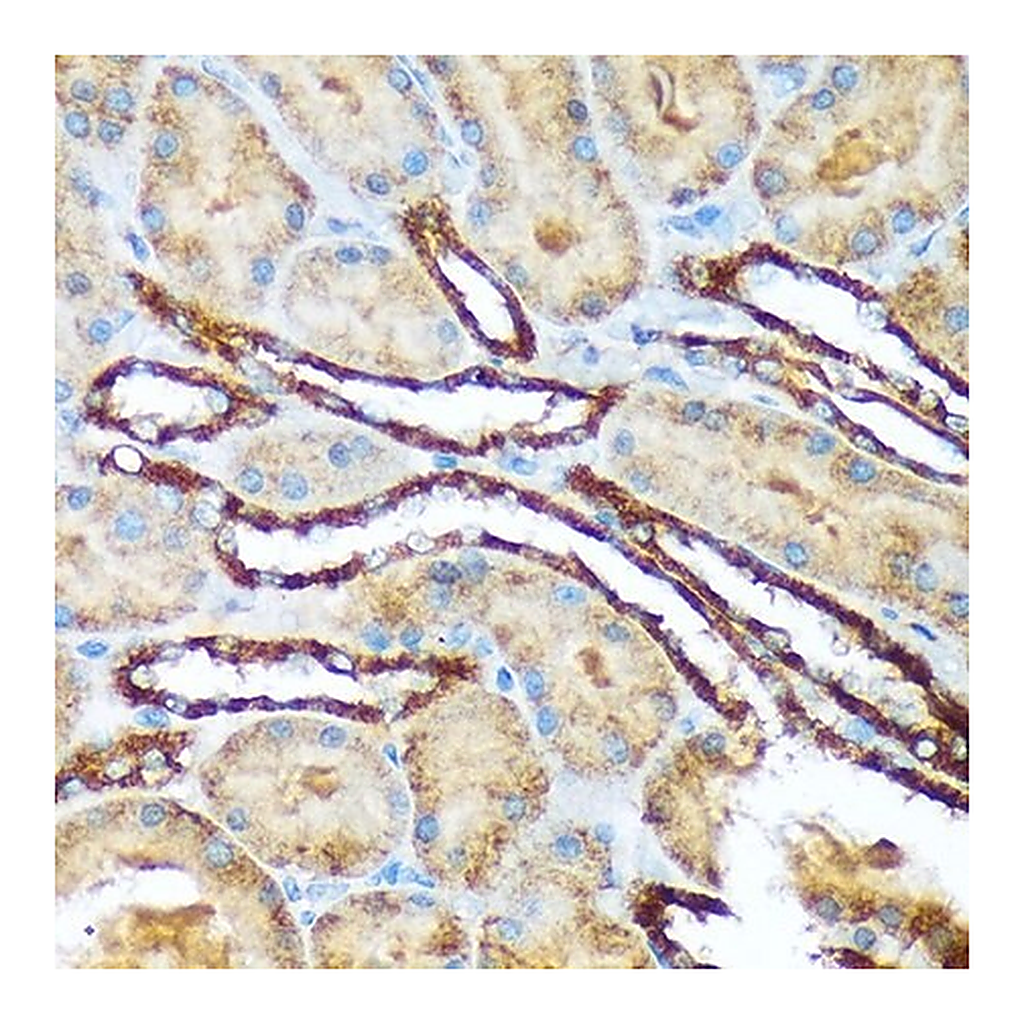 Merck Anti-Versican antibody produced in rabbit