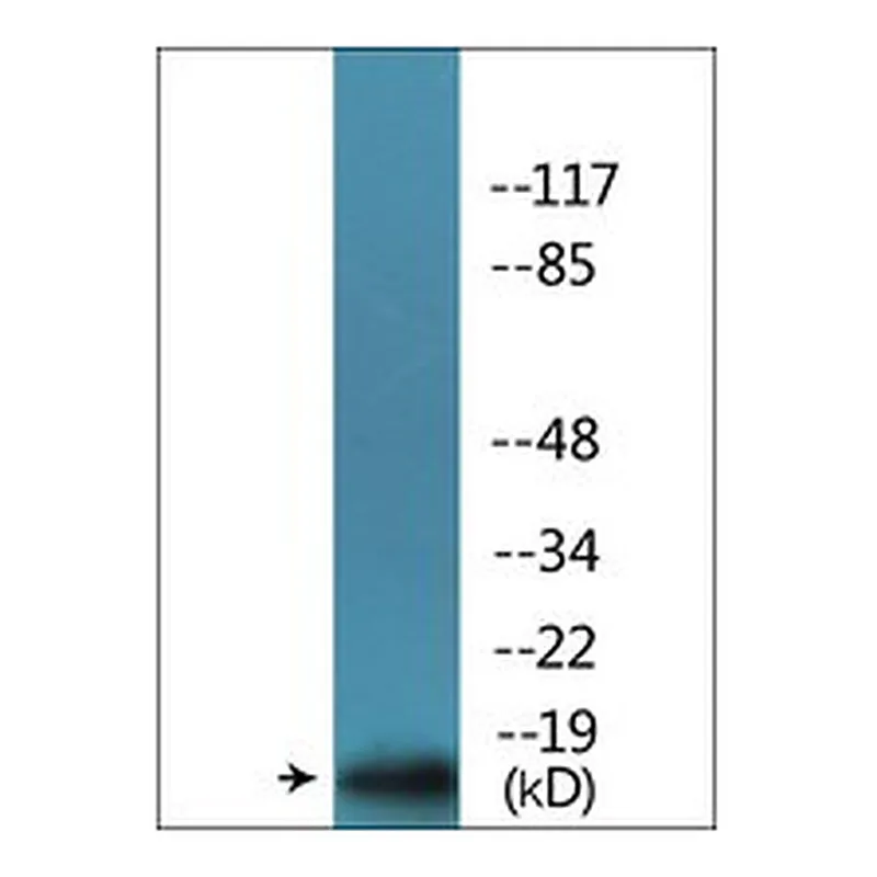 Merck ANTI-PHOSPHO-P16-INK4A (PSER152)