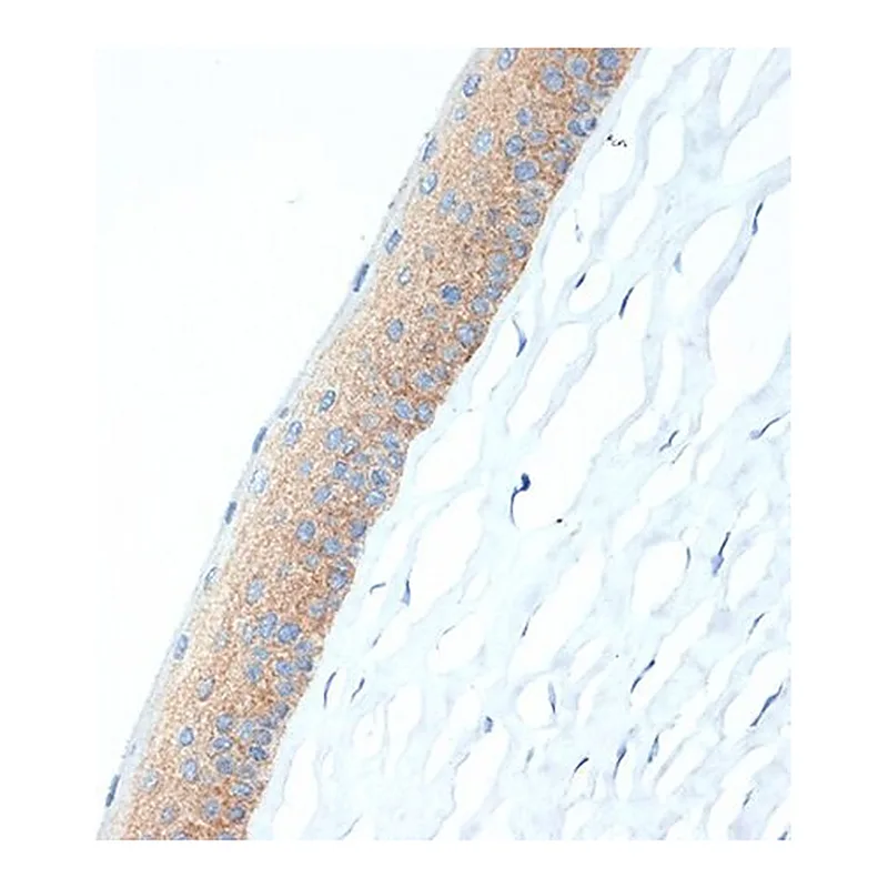 Merck Anti-CRABP1 antibody produced in rabbit