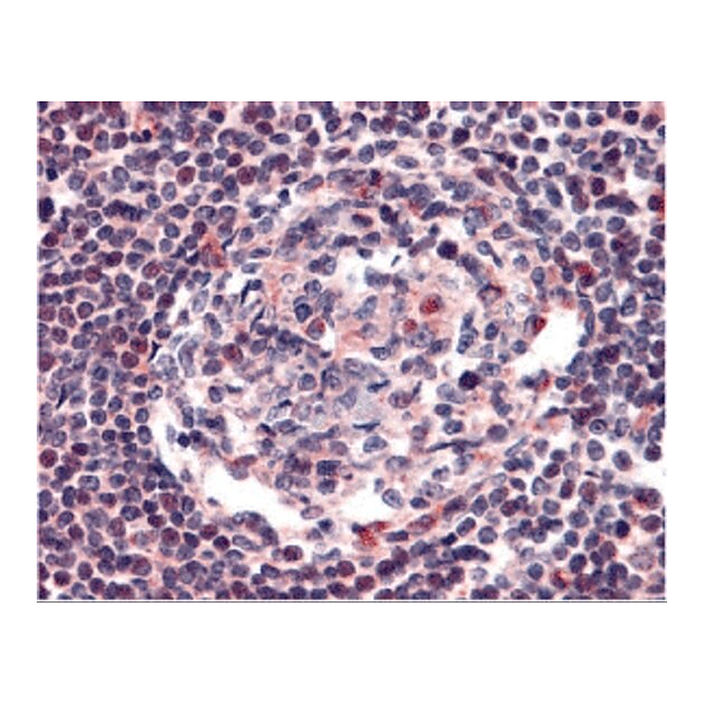 Merck Anti-CCR5 antibody produced in rabbit