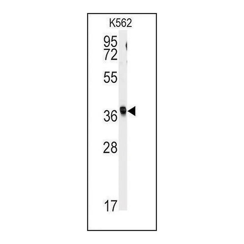 Merck Anti-RFC2 (N-term) antibody produced in rabbit