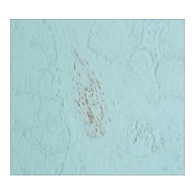 Merck ANTI-HNK-1/N-CAM (CD57) ANTIBODY, MOUSE&