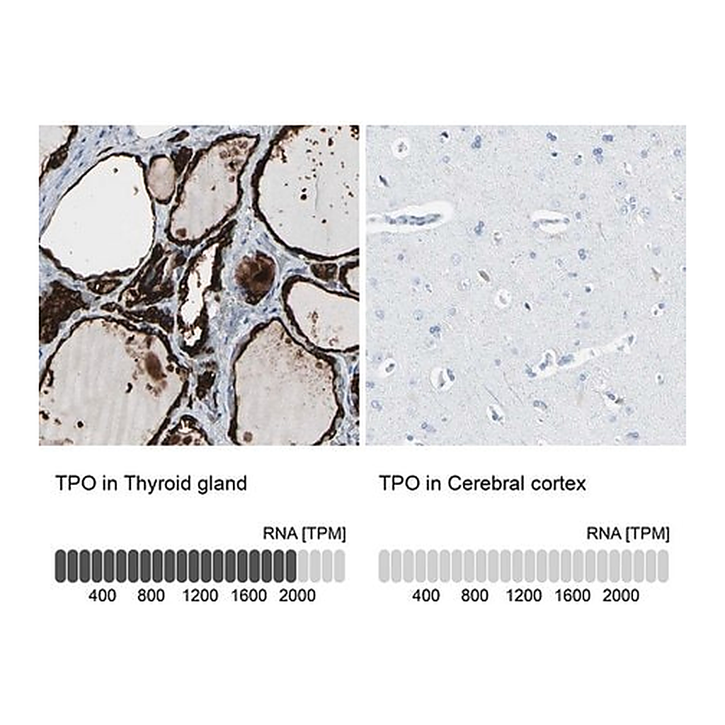 Merck Anti-TPO antibody produced in rabbit