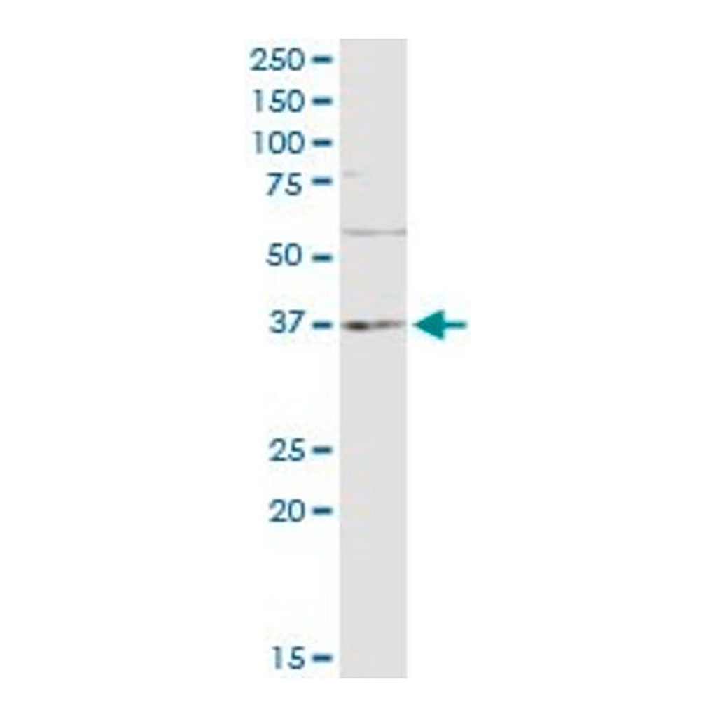 Merck Monoclonal Anti-TNF antibody produced in mouse