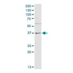 Merck Monoclonal Anti-TNF antibody produced in mouse