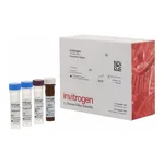 Thermo Fisher Scientific Human Uromodulin ProcartaPlex Simplex Kit