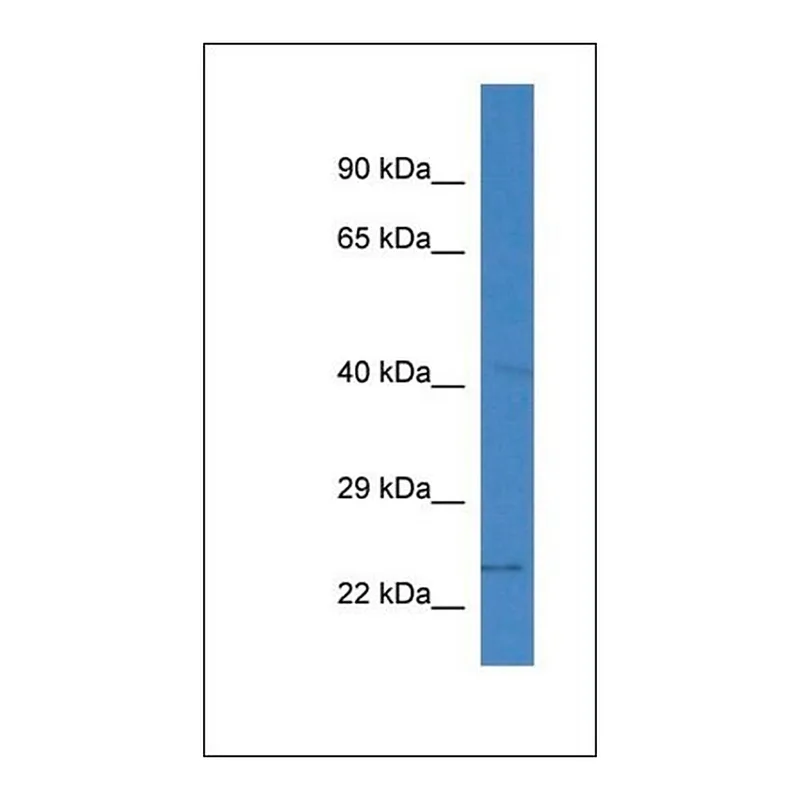 Merck Anti-SLC10A2 antibody produced in rabbit