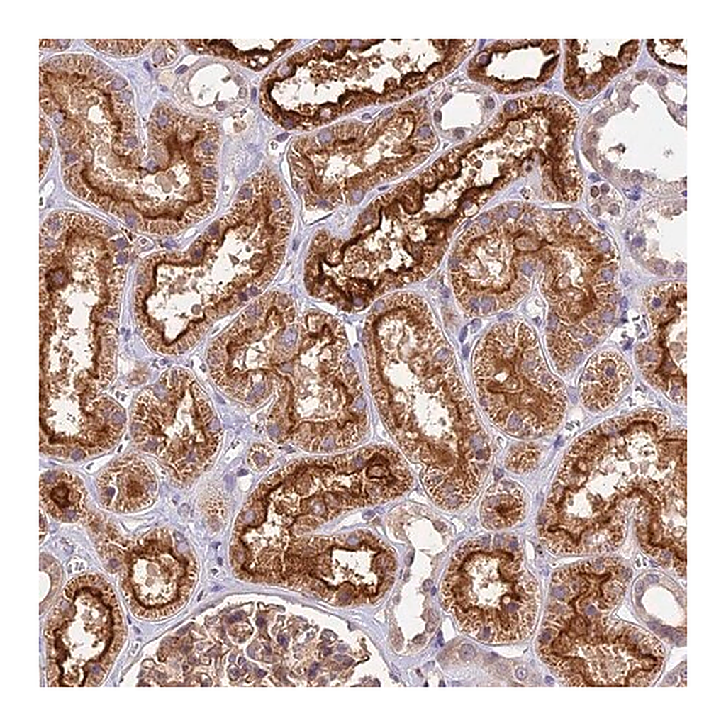Merck Anti-TBC1D1 antibody produced in rabbit