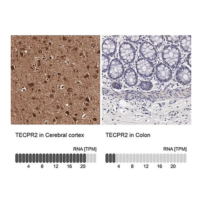 Merck Anti-TECPR2 antibody produced in rabbit