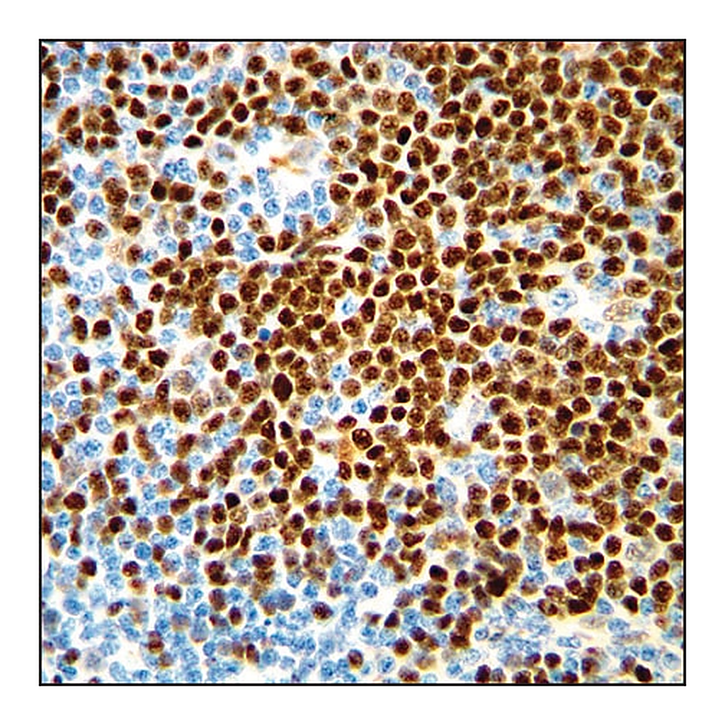 Merck Anti-Cyclin D1 antibody, Rabbit monoclonal