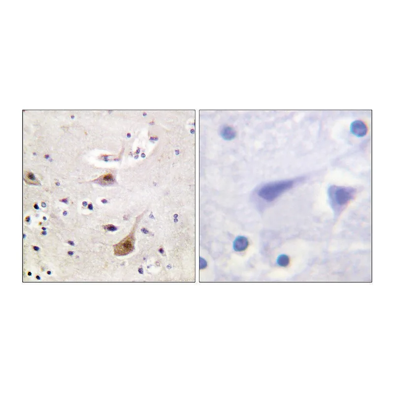 Merck Anti-Androgen Receptor, N-Terminal antibody produced in rabbit