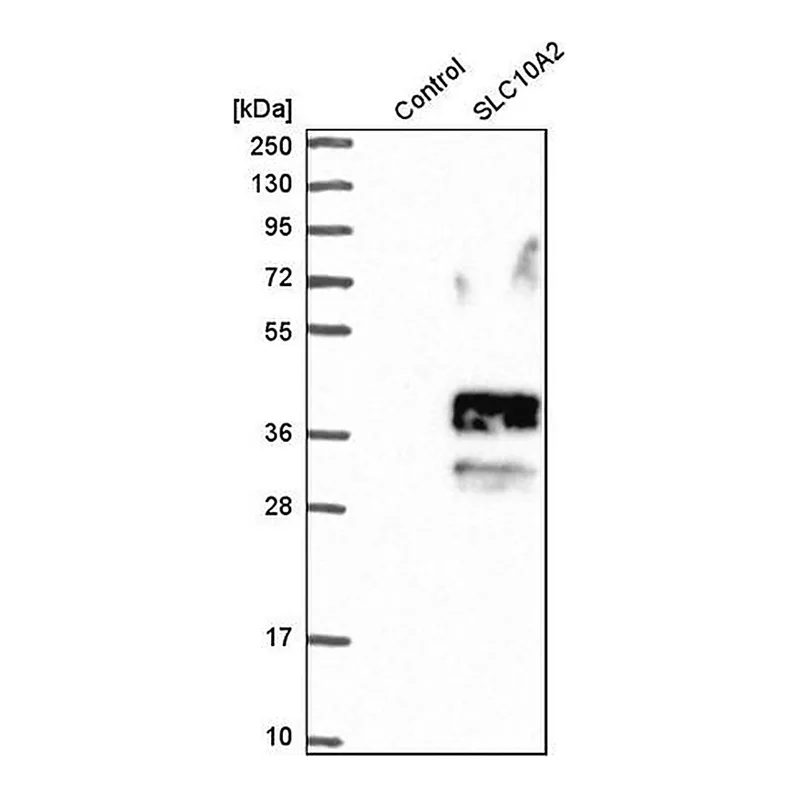 Merck Anti-SLC10A2 antibody produced in rabbit