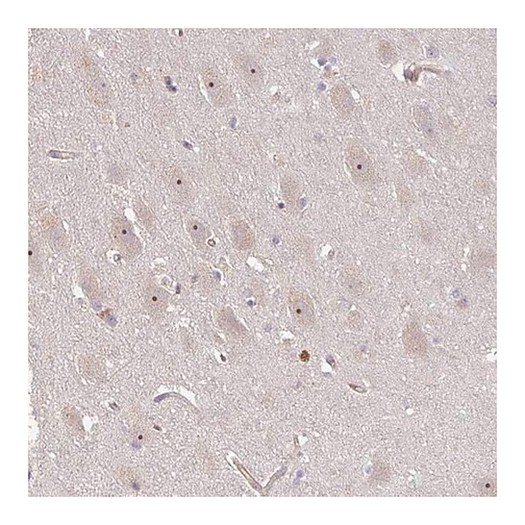 Merck Anti-DIMT1 antibody produced in rabbit